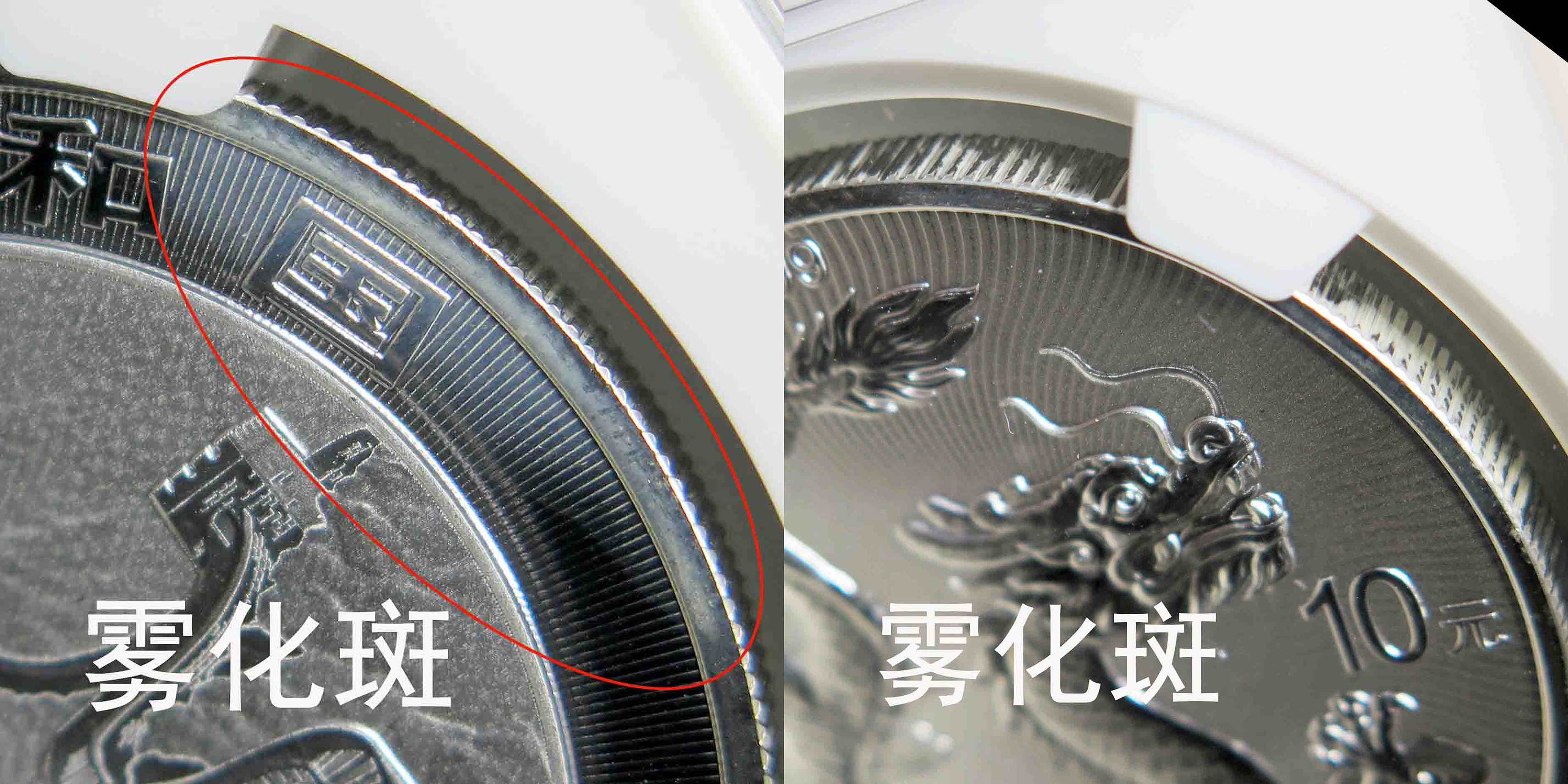 A雾化白斑.jpg
